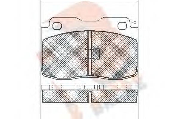 R BRAKE RB0473