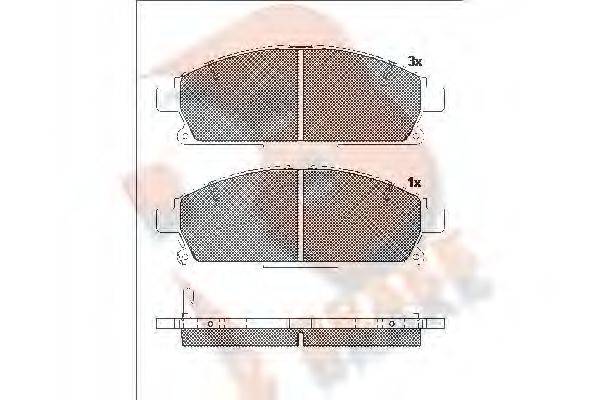 R BRAKE RB1521-200