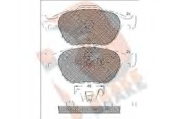 R BRAKE RB1537