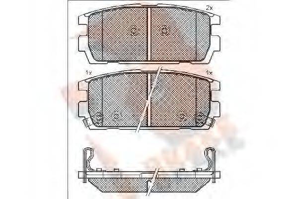 R BRAKE RB1615