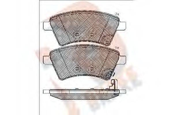 R BRAKE RB1758