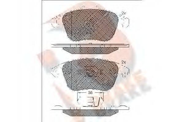 R BRAKE RB1866